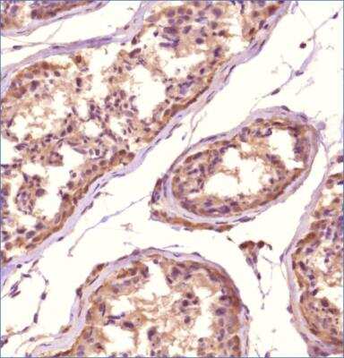 Immunohistochemistry-Paraffin TMEM49 Antibody - BSA Free