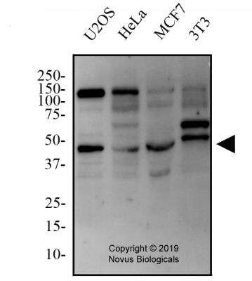 Western Blot TMEM49 Antibody - BSA Free