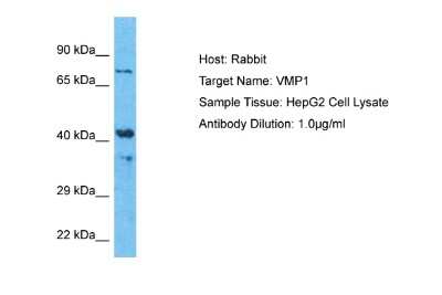 Western Blot: TMEM49 Antibody [NBP2-88441] - Host: Rabbit. Target Name: VMP1. Sample Type: HepG2 Whole Cell lysates. Antibody Dilution: 1.0ug/ml