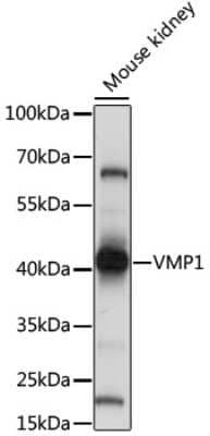 Western Blot: TMEM49 Antibody [NBP2-93149] - Analysis of extracts of mouse kidney, using TMEM49 at 1:1000 dilution.Secondary antibody: HRP Goat Anti-Rabbit IgG (H+L) at 1:10000 dilution.Lysates/proteins: 25ug per lane.Blocking buffer: 3% nonfat dry milk in TBST.Detection: ECL Basic Kit .Exposure time: 5s.