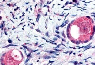 Immunohistochemistry-Paraffin: TMEM5 Antibody [NB110-40445] - Analysis of anti-TMEM5 antibody with human ovary, oocytes at concentration 5 ug/ml.