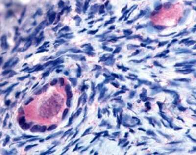 Immunohistochemistry-Paraffin: TMEM5 Antibody [NB110-40446] - Analysis of anti-TMEM5 antibody with human ovary, oocytes.