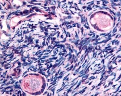 Immunohistochemistry-Paraffin: TMEM5 Antibody [NB110-40447] - Analysis of anti-TMEM5 antibody with human ovary, oocytes.