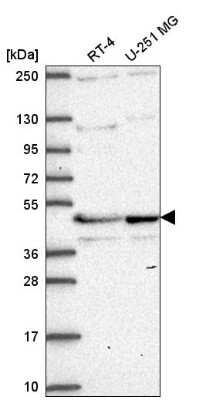 Western Blot TMEM5 Antibody