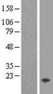 Western Blot: TMEM50B Overexpression Lysate (Adult Normal) [NBL1-17087] Left-Empty vector transfected control cell lysate (HEK293 cell lysate); Right -Over-expression Lysate for TMEM50B.