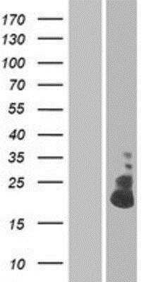 Western Blot: TMEM52B Overexpression Lysate (Native) [NBP2-05292] - TMEM52B Overexpression Lysate (Native) Left-Empty vector transfected control cell lysate (HEK293 cell lysate); Right -Over-expression Lysate for C12orf59.