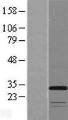 Western Blot: TMEM53 Overexpression Lysate (Adult Normal) [NBL1-17089] Left-Empty vector transfected control cell lysate (HEK293 cell lysate); Right -Over-expression Lysate for TMEM53.
