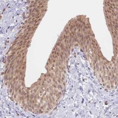 Immunohistochemistry-Paraffin: TMEM55B Antibody [NBP2-13453] - Staining of human urinary bladder shows moderate nuclear and cytoplasmic positivity in urothelial cells.