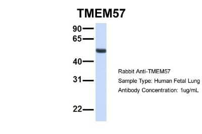 Western Blot: TMEM57 Antibody [NBP1-59709] - Human Fetal Lung, Antibody Dilution: 1.0 ug/ml.