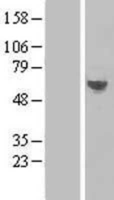 Western Blot: TMEM57 Overexpression Lysate (Adult Normal) [NBL1-17092] - Western Blot experiments.  Left-Control; Right -Over-expression Lysate for TMEM57