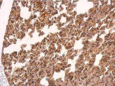 Immunohistochemistry-Paraffin TMEM59 Antibody