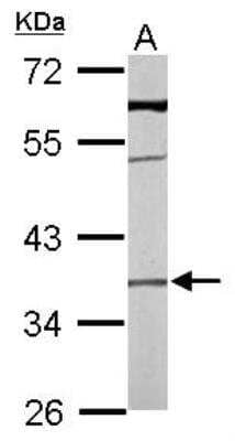 Western Blot: TMEM59 Antibody [NBP1-32303] - Sample (50 ug of whole cell lysate) A: mouse liver 10% SDS PAGE diluted at 1:1000