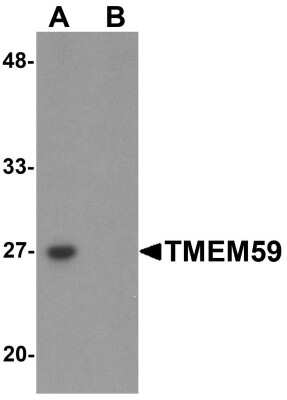 Western Blot: TMEM59 Antibody [NBP1-76497] - Human kidney tissue lysate with TMEM59 antibody at 1 ug/mL in (A) the absence and (B) the presence of blocking peptide.