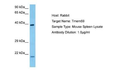 Western Blot: TMEM59 Antibody [NBP2-82359] - Host: Rabbit. Target Name: TMEM59. Sample Tissue: Mouse Spleen lysates. Antibody Dilution: 1ug/ml