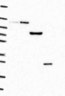 Western Blot: TMEM59 Antibody [NBP3-17950] - Lane 1: Marker [kDa] 250, 130, 95, 72, 55, 36, 28, 17, 10;   Lane 2: RT4;   Lane 3: U-251 MG;   Lane 4: Human Plasma;   Lane 5: Liver;   Lane 6: Tonsil