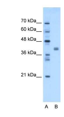 Western Blot: TMEM59L Antibody [NBP1-62564] - Titration: 1.25ug/ml Positive Control: Transfected 293T.