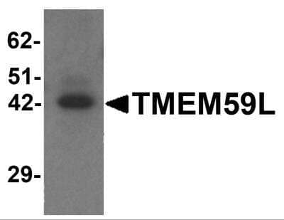 Western Blot TMEM59L Antibody - BSA Free