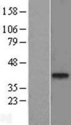 Western Blot: TMEM59L Overexpression Lysate (Adult Normal) [NBL1-17094] Left-Empty vector transfected control cell lysate (HEK293 cell lysate); Right -Over-expression Lysate for TMEM59L.