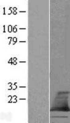 Western Blot: TMEM60 Overexpression Lysate (Adult Normal) [NBL1-17095] Left-Empty vector transfected control cell lysate (HEK293 cell lysate); Right -Over-expression Lysate for TMEM60.