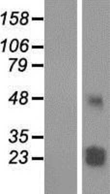 Western Blot: TMEM61 Overexpression Lysate (Adult Normal) [NBP2-04854] Left-Empty vector transfected control cell lysate (HEK293 cell lysate); Right -Over-expression Lysate for TMEM61.