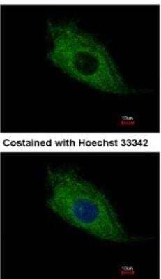 Immunocytochemistry/ Immunofluorescence TMEM66 Antibody