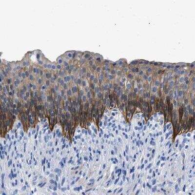 Immunohistochemistry-Paraffin: TMEM68 Antibody [NBP1-81999] - Staining of human urinary bladder shows cytoplasmic and membranous positivity in urothelial cells.