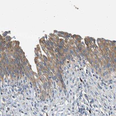 Immunohistochemistry-Paraffin TMEM68 Antibody