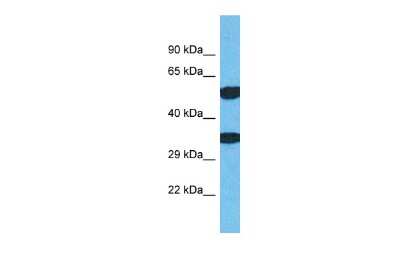 Western Blot: TMEM68 Antibody [NBP2-85951] - Host: Rabbit. Target Name: TMEM68. Sample Type: Jurkat Whole Cell lysates. Antibody Dilution: 1.0ug/ml