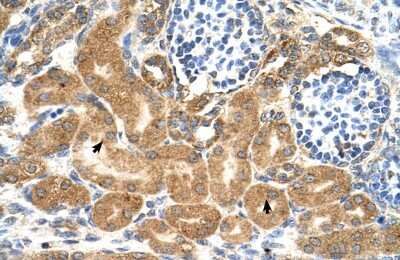 Immunohistochemistry TMEM69 Antibody - BSA Free