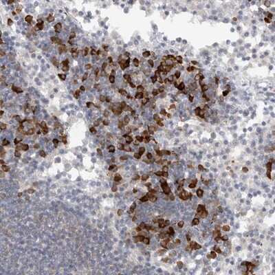 Immunohistochemistry-Paraffin: TMEM69 Antibody [NBP1-90713] - Staining of human lymph node shows strong cytoplasmic positivity in lymphoid cells outside reaction centra.