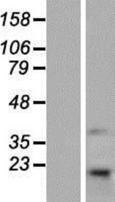 Western Blot TMEM69 Overexpression Lysate