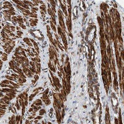 Immunohistochemistry: TMEM70 Antibody [NBP2-13456] - Staining of human smooth muscle shows strong cytoplasmic positivity in smooth muscle cells.