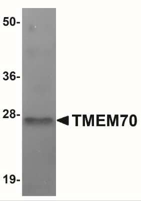Western Blot TMEM70 Antibody - BSA Free