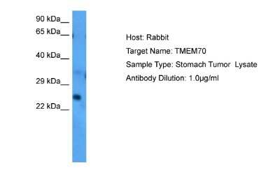 Western Blot: TMEM70 Antibody [NBP2-85952] - Host: Rabbit. Target Name: TMEM70. Sample Tissue: Human Stomach Tumor. Antibody Dilution: 1.0ug/ml