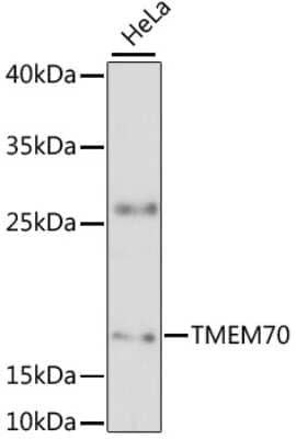Western Blot: TMEM70 Antibody [NBP2-94628] - Analysis of extracts of HeLa cells, using TMEM70 at 1:3000 dilution.Secondary antibody: HRP Goat Anti-Rabbit IgG (H+L) at 1:10000 dilution.Lysates/proteins: 25ug per lane.Blocking buffer: 3% nonfat dry milk in TBST.Detection: ECL Basic Kit .Exposure time: