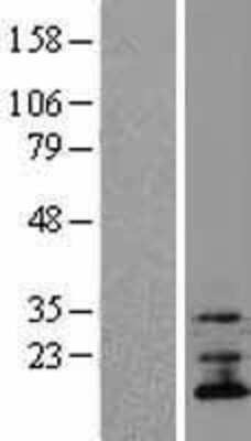 Western Blot: TMEM70 Overexpression Lysate (Adult Normal) [NBL1-17101] Left-Empty vector transfected control cell lysate (HEK293 cell lysate); Right -Over-expression Lysate for TMEM70.