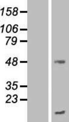 Western Blot: TMEM70 Overexpression Lysate (Adult Normal) [NBP2-08514] Left-Empty vector transfected control cell lysate (HEK293 cell lysate); Right -Over-expression Lysate for TMEM70.