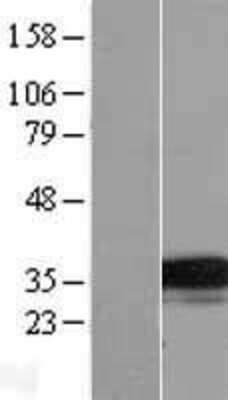 Western Blot: TMEM74 Overexpression Lysate (Adult Normal) [NBL1-17103] Left-Empty vector transfected control cell lysate (HEK293 cell lysate); Right -Over-expression Lysate for TMEM74.