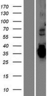 Western Blot: TMEM74B Overexpression Lysate (Native) [NBP2-06815] - TMEM74B Overexpression Lysate (Native) Left-Empty vector transfected control cell lysate (HEK293 cell lysate); Right -Over-expression Lysate for C20orf46.