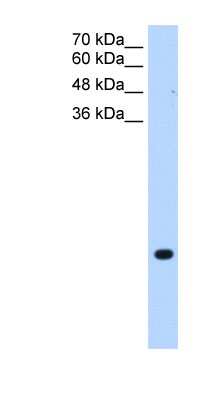 Western Blot: TMEM75 Antibody [NBP1-59685] - Jurkat cell lysate, concentration 0.2-1 ug/ml.