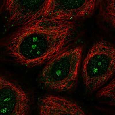 Immunocytochemistry/Immunofluorescence: TMEM79 Antibody [NBP2-47601] - Staining of human cell line MCF7 shows localization to nucleoli fibrillar center.
