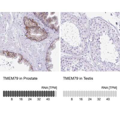 Immunohistochemistry-Paraffin: TMEM79 Antibody [NBP2-47601] - Analysis in human prostate and testis tissues. Corresponding TMEM79 RNA-seq data are presented for the same tissues.