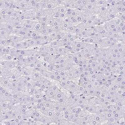Immunohistochemistry-Paraffin: TMEM79 Antibody [NBP2-47601] - Staining of human liver shows no positivity in hepatocytes.