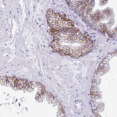 Immunohistochemistry-Paraffin: TMEM79 Antibody [NBP2-47601] - Staining of human prostate strong membranous/cytoplasmic positivity in glandular cells.