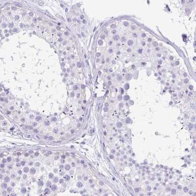 Immunohistochemistry-Paraffin: TMEM79 Antibody [NBP2-47601] - Staining of human testis shows no positivity in cells in seminiferous ducts.
