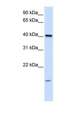 Western Blot TMEM79 Antibody - BSA Free