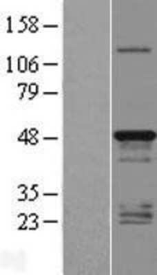 Western Blot TMEM79 Overexpression Lysate