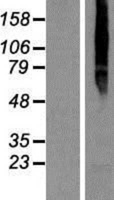 Western Blot TMEM8 Overexpression Lysate