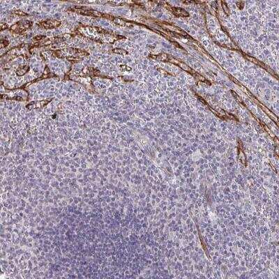 Immunohistochemistry-Paraffin: TMEM82 Antibody [NBP2-31814] - Staining of human spleen shows distinct positivity in splenic sinusoids.