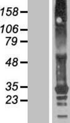 Western Blot: TMEM82 Overexpression Lysate (Adult Normal) [NBP2-08725] Left-Empty vector transfected control cell lysate (HEK293 cell lysate); Right -Over-expression Lysate for TMEM82.